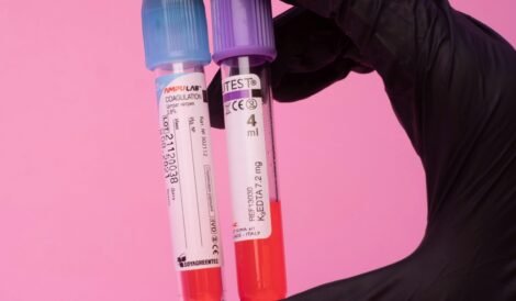 therapeutic drug monitoring clinical pharmacy course- clinicalpharmacourses